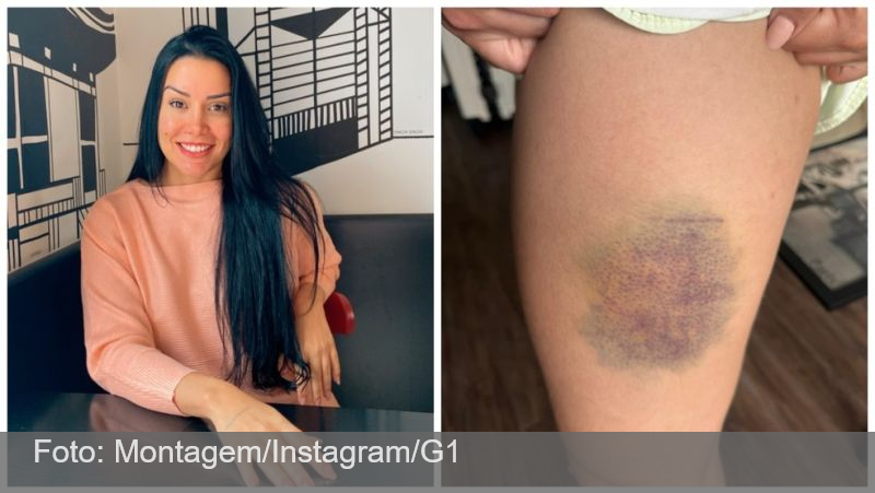 Nutricionista lutou por 13 minutos contra agressor que invadiu sua casa na Grande SP para estuprá-la: ‘Briguei pela vida’