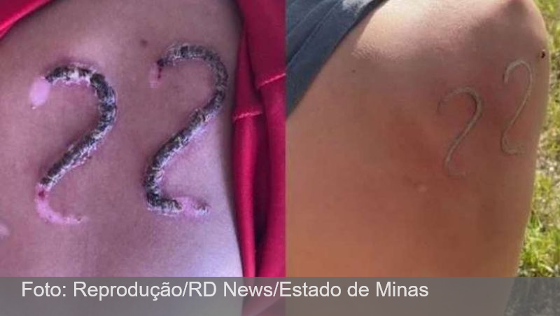 Adolescente usa ferro em brasa para marcar número de Bolsonaro