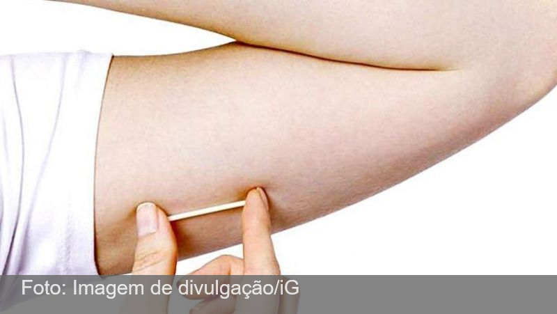Anvisa proíbe propaganda do 'chip da beleza' no Brasil; entenda