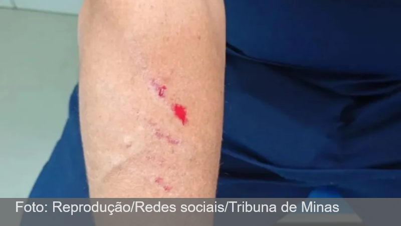 Técnica de Enfermagem é vítima de agressão no HPS, em Juiz de Fora
