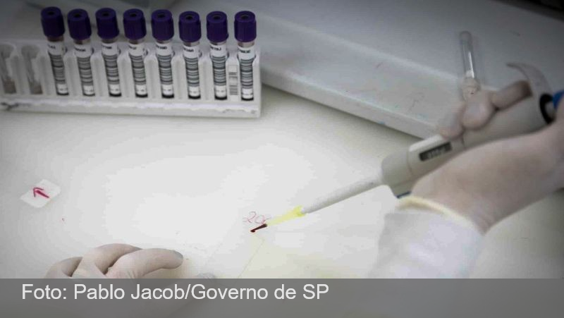 Paciente em SP com suspeita de ebola testa positivo para meningite