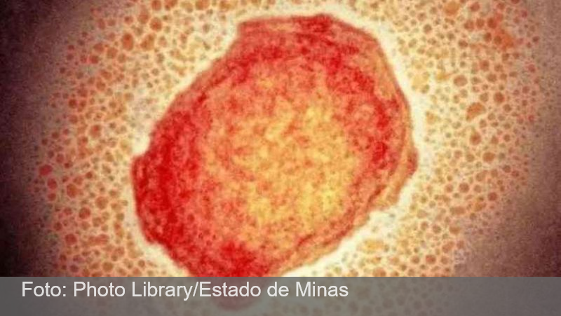 Minas Gerais pode ter três casos de varíola dos macacos