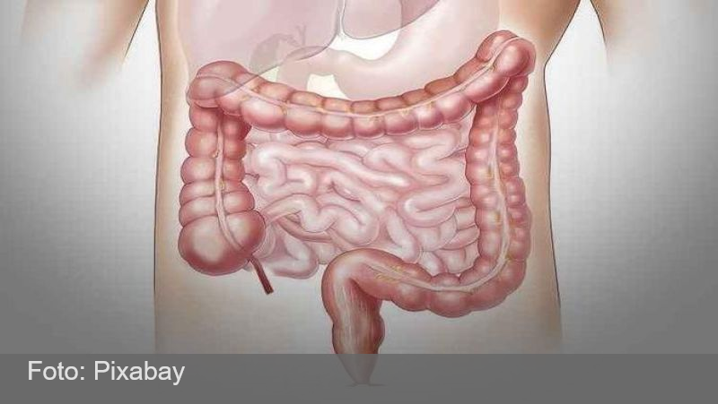 SUS adota novo exame para detectar câncer de intestino antes dos sintomas
