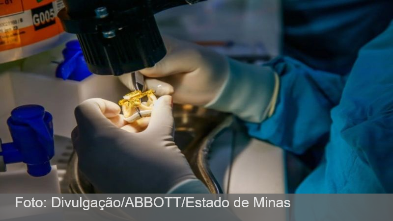 100% mineira: válvula cardíaca fabricada em MG é distribuída mundialmente