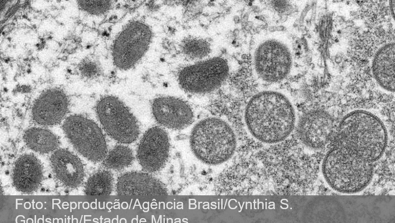 Minas investiga o 1º caso suspeito de varíola dos macacos